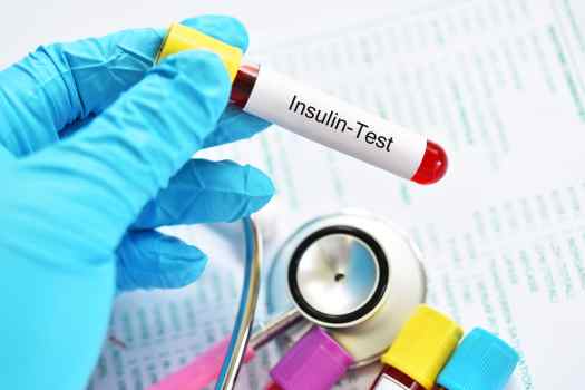 Insulinresistenz Test